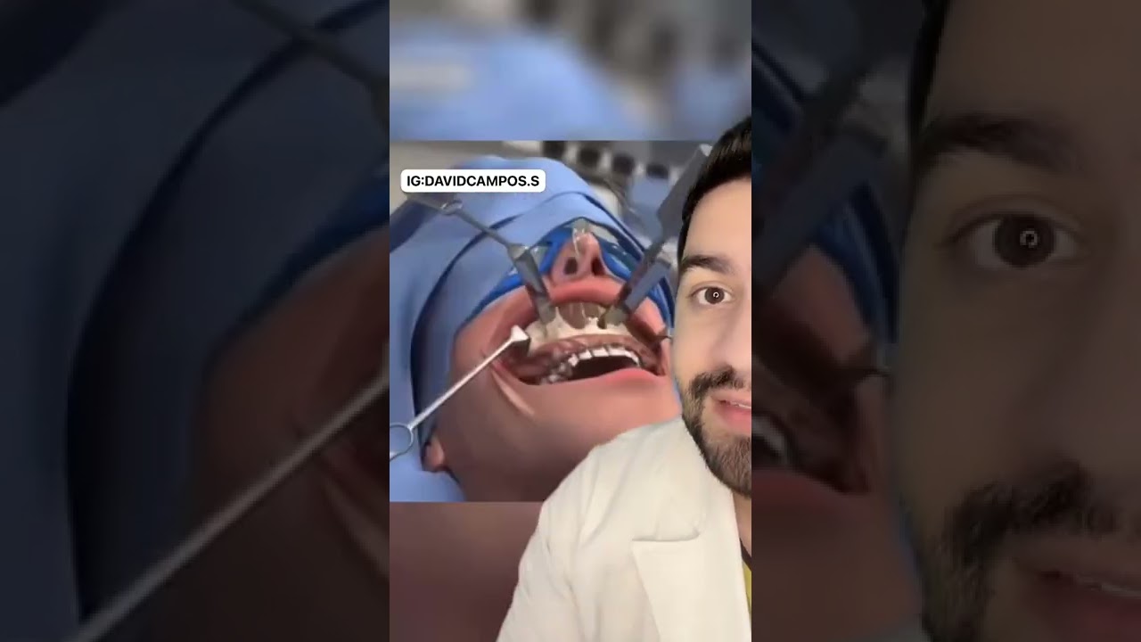 Cirugia de cara completa