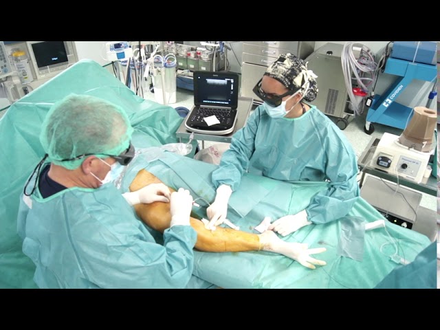 Cirugia vascular piernas